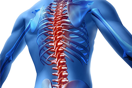 Spinal Cord Injuries The Weyer Law Firm